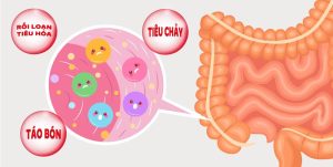 hỗ trợ cải thiện hệ tiêu hóa